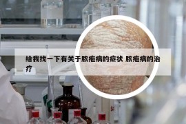 給我找一下有關(guān)于膿皰病的癥狀 膿皰病的治療