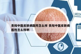 貴陽中醫(yī)皮膚病醫(yī)院怎么樣 貴陽中醫(yī)皮膚病醫(yī)院怎么樣啊