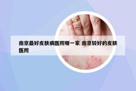 南京最好皮膚病醫(yī)院哪一家 南京較好的皮膚醫(yī)院
