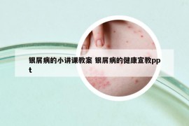 銀屑病的小講課教案 銀屑病的健康宣教ppt