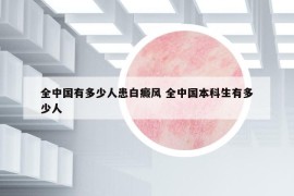 全中國有多少人患白癜風(fēng) 全中國本科生有多少人