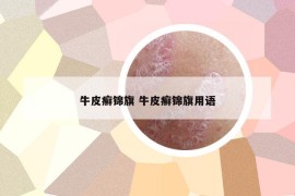 牛皮癬錦旗 牛皮癬錦旗用語