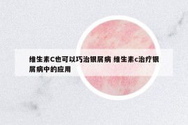 維生素C也可以巧治銀屑病 維生素c治療銀屑病中的應(yīng)用