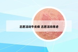 志愿活動(dòng)牛皮癬 志愿活動(dòng)事跡