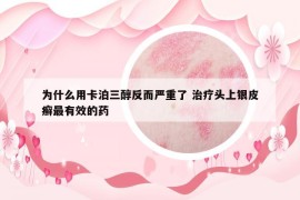 為什么用卡泊三醇反而嚴(yán)重了 治療頭上銀皮癬最有效的藥
