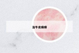 治牛皮癬癢