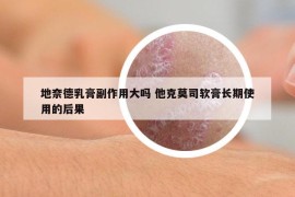 地奈德乳膏副作用大嗎 他克莫司軟膏長(zhǎng)期使用的后果