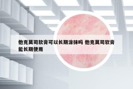 他克莫司軟膏可以長期涂抹嗎 他克莫司軟膏能長期使用