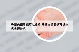 母豬肉銀屑病可以吃嗎 母豬肉銀屑病可以吃嗎有營養(yǎng)嗎