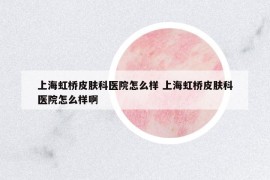 上海虹橋皮膚科醫(yī)院怎么樣 上海虹橋皮膚科醫(yī)院怎么樣啊