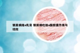 銀屑病維a乳膏 銀屑病吃維a酸膠囊作用與功效