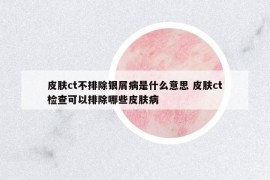 皮膚ct不排除銀屑病是什么意思 皮膚ct檢查可以排除哪些皮膚病