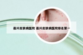 嘉興皮膚病醫(yī)院 嘉興皮膚病醫(yī)院排名第一