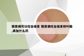 銀屑病可以吃谷維素 銀屑病吃谷維素和葉酸,再加什么藥