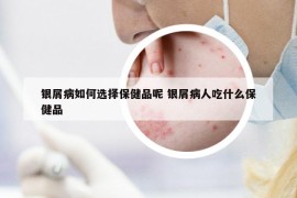 銀屑病如何選擇保健品呢 銀屑病人吃什么保健品
