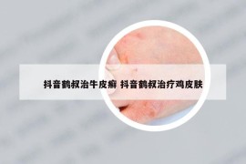 抖音鶴叔治牛皮癬 抖音鶴叔治療雞皮膚