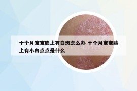 十個(gè)月寶寶臉上有白斑怎么辦 十個(gè)月寶寶臉上有小白點(diǎn)點(diǎn)是什么