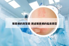 銀屑病的簡(jiǎn)答題 簡(jiǎn)述銀屑病的臨床類型