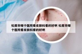 松原市哪個醫(yī)院看皮膚科看的好啊 松原市哪個醫(yī)院看皮膚科看的好啊