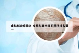 皮膚科北京排名 皮膚科北京哪家醫(yī)院排名第一