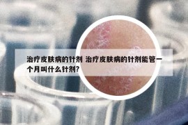 治療皮膚病的針劑 治療皮膚病的針劑能管一個(gè)月叫什么針劑?