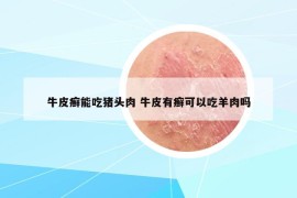 牛皮癬能吃豬頭肉 牛皮有癬可以吃羊肉嗎