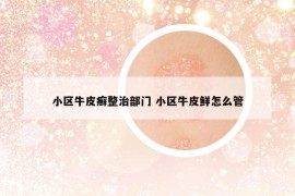 小區(qū)牛皮癬整治部門 小區(qū)牛皮鮮怎么管