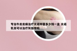 專治牛皮皮癬治療太諾抑菌多少錢一盒 太諾乳膏可以治療灰指甲嗎