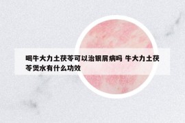 喝牛大力土茯苓可以治銀屑病嗎 牛大力土茯苓煲水有什么功效