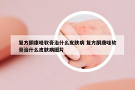 復(fù)方酮康唑軟膏治什么皮膚病 復(fù)方酮康唑軟膏治什么皮膚病圖片