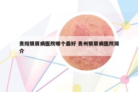 貴陽銀屑病醫(yī)院哪個最好 貴州銀屑病醫(yī)院簡介