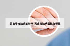 靈寶看皮膚病的診所 靈寶皮膚病醫(yī)院在哪里