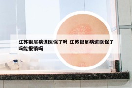 江蘇銀屑病進(jìn)醫(yī)保了嗎 江蘇銀屑病進(jìn)醫(yī)保了嗎能報銷嗎