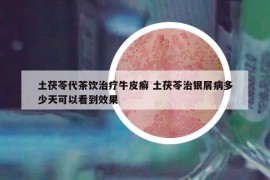 土茯苓代茶飲治療牛皮癬 土茯苓治銀屑病多少天可以看到效果