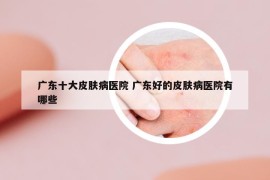 廣東十大皮膚病醫(yī)院 廣東好的皮膚病醫(yī)院有哪些