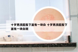 十歲男孩屁股下面有一塊白 十歲男孩屁股下面有一塊白斑