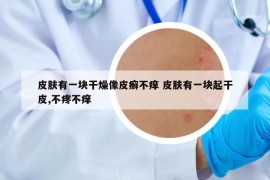 皮膚有一塊干燥像皮癬不癢 皮膚有一塊起干皮,不疼不癢