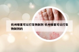 杭州哪里可以打生物制劑 杭州哪里可以打生物制劑的