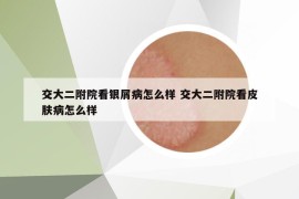 交大二附院看銀屑病怎么樣 交大二附院看皮膚病怎么樣