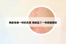 胸前有癬一樣的東西 胸前起了一塊癬圓圈狀