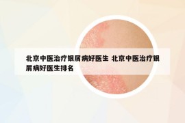 北京中醫(yī)治療銀屑病好醫(yī)生 北京中醫(yī)治療銀屑病好醫(yī)生排名