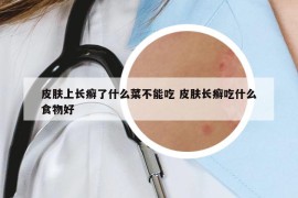 皮膚上長(zhǎng)癬了什么菜不能吃 皮膚長(zhǎng)癬吃什么食物好