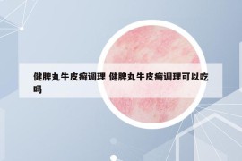 健脾丸牛皮癬調(diào)理 健脾丸牛皮癬調(diào)理可以吃嗎