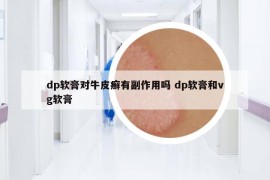 dp軟膏對牛皮癬有副作用嗎 dp軟膏和vg軟膏