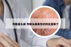 判斷是頭癬 判斷頭癬典型的特征是哪個(gè)