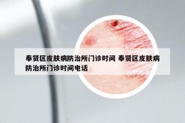 奉賢區(qū)皮膚病防治所門診時間 奉賢區(qū)皮膚病防治所門診時間電話