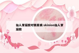 仙人掌凝膠對銀屑病 skinion仙人掌凝膠
