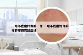 一堆小疙瘩好像癬一樣 一堆小疙瘩好像癬一樣特癢撓完過后紅