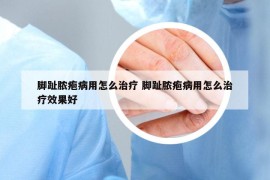 腳趾膿皰病用怎么治療 腳趾膿皰病用怎么治療效果好