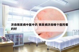 濟南銀屑病中醫(yī)中藥 銀屑病濟南哪個醫(yī)院看的好